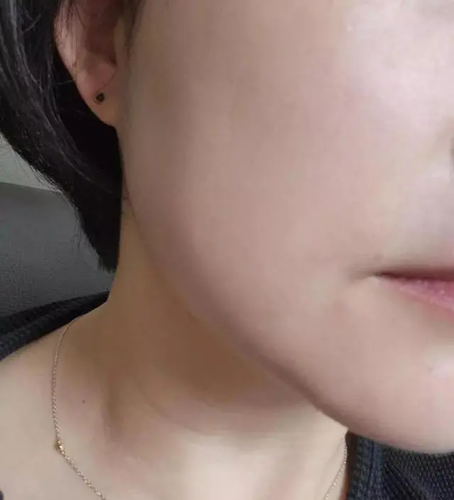 [네이버 스마트스토어 리뷰] 첫구매후 2통을 먹었는데 피부가 좋아지고, 살이 빠지기 시작해서 추가구매했어요~
