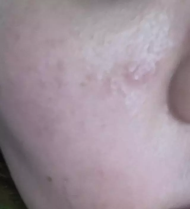 [네이버 스마트스토어 리뷰] 카메라가 구려서 잘티는 안나지만 최근 피부결이 좋아진거같은 느낌은 있어요. 속당김은