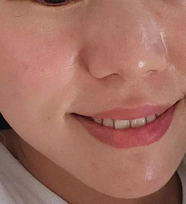 [네이버 스마트스토어 리뷰] 사용한지 약 두달 정도 된거 같은데 오랜만에 만난 지인들이 피부가 왜이렇게 좋아졌냐