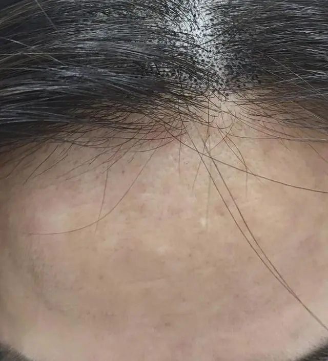 첫날해보고 담날까지 반짝거림에 오~ 했는데요.  제가 두피문신을하느라 사진정보가 남
