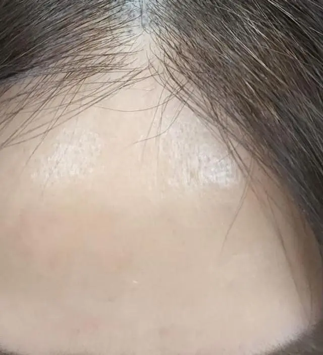 첫날해보고 담날까지 반짝거림에 오~ 했는데요.  제가 두피문신을하느라 사진정보가 남