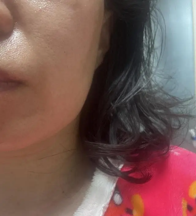 쿼드쎄라를 사기 위해 이것저것 많이 정보를 알아 본 후에 구매했습니다. 아직 1번 밖에