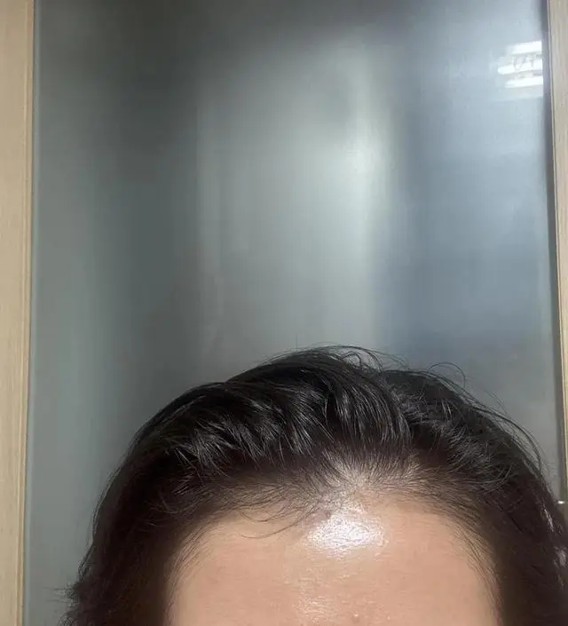 쿼드쎄라를 사기 위해 이것저것 많이 정보를 알아 본 후에 구매했습니다. 아직 1번 밖에