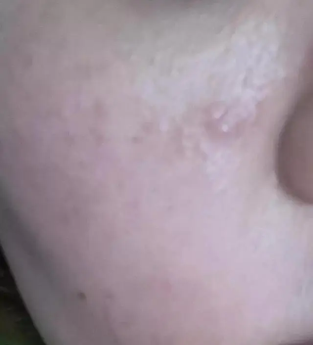 [네이버 스마트스토어 리뷰] 카메라가 구려서 잘티는 안나지만 최근 피부결이 좋아진거같은 느낌은 있어요. 속당김은