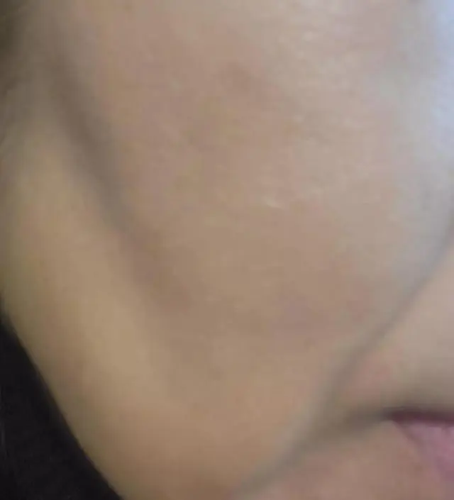 [네이버 스마트스토어 리뷰] 받자마자 5일간 아침에 5분, 저녁에 20분정도 꾸준히 했어요. 딸이 보고는 피부가 훨씬