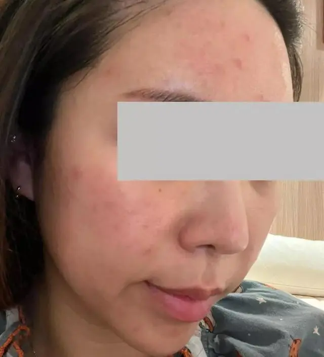 [네이버 스마트스토어 리뷰] 저는 결혼식 이후로 야식, 새벽취침, 밀가루음식위주, 맵고짠 음식위주의 생활을 정확히