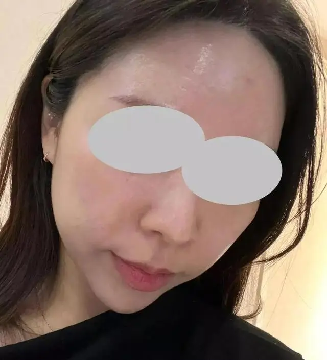 [네이버 스마트스토어 리뷰] 이젠 생리전에 뾰루지 올라오는거 말고는 거의 여드름 안나요 ㅎㅎㅎ2-4번 10분씩 해요