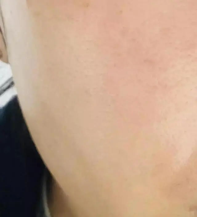 [네이버 스마트스토어 리뷰] 피부가 쫀쫀해지는 느낌입니다 좋아요!