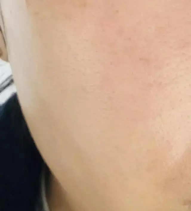 [네이버 스마트스토어 리뷰] 피부가 쫀쫀해지는 느낌입니다 좋아요!