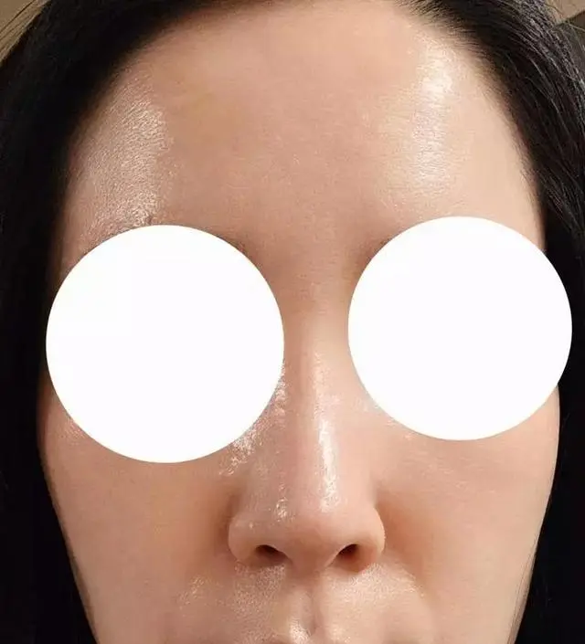 [네이버 스마트스토어 리뷰] 첫 사용후기에 적었듯이 제 피부는 악지성에 속건조, 초민감성이라 화장품을 잘 못바꾸