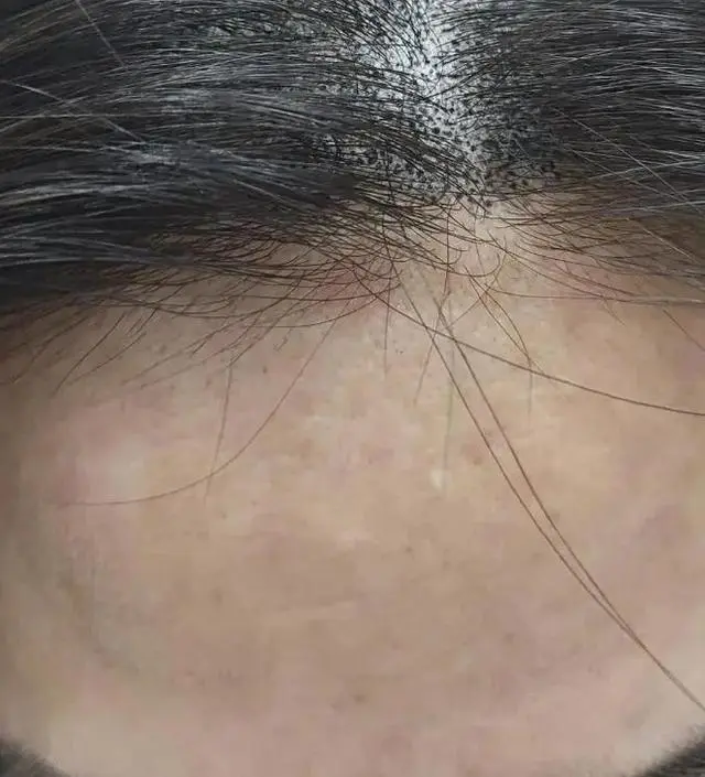 첫날해보고 담날까지 반짝거림에 오~ 했는데요.  제가 두피문신을하느라 사진정보가 남