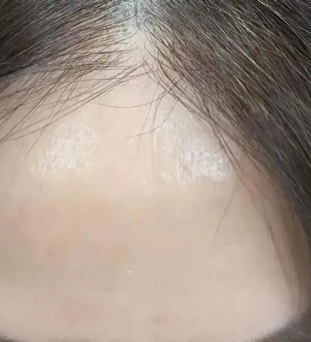 첫날해보고 담날까지 반짝거림에 오~ 했는데요.  제가 두피문신을하느라 사진정보가 남