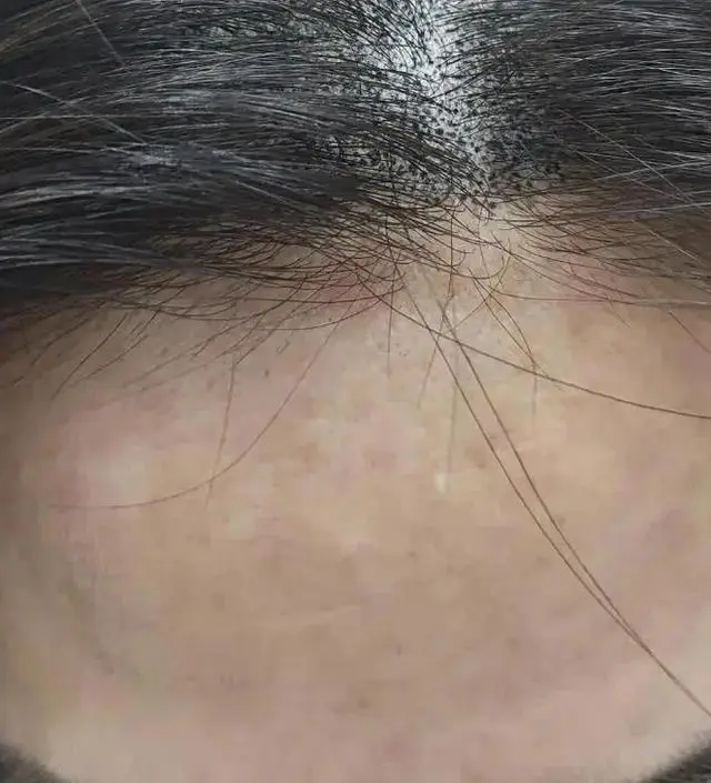 첫날해보고 담날까지 반짝거림에 오~ 했는데요.  제가 두피문신을하느라 사진정보가 남