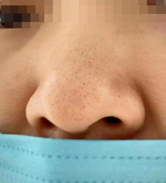 저는 최근까지 마스크를 계속 쓰고 댕겼어요

