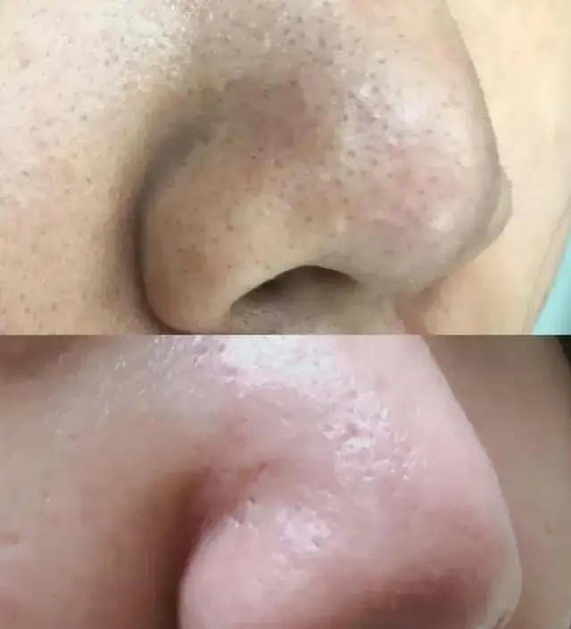 정말 최고입니다. 다른 말이 필요 없어요.
