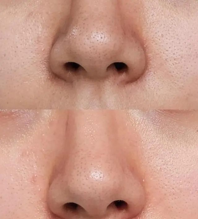 오늘 처음 써봤어요 원래 리뷰 이렇게 정성스럽게 안남기는데 이거는 한번쓰고 너무 좋