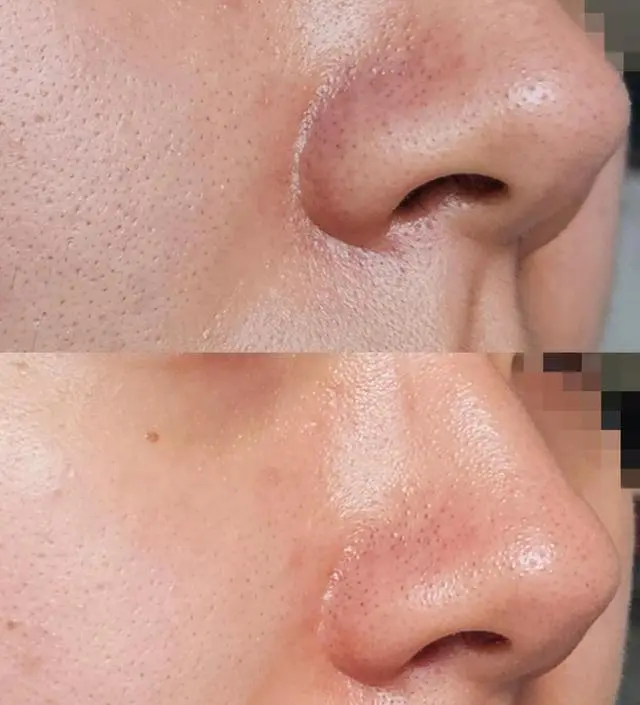 오늘 처음 써봤어요 원래 리뷰 이렇게 정성스럽게 안남기는데 이거는 한번쓰고 너무 좋
