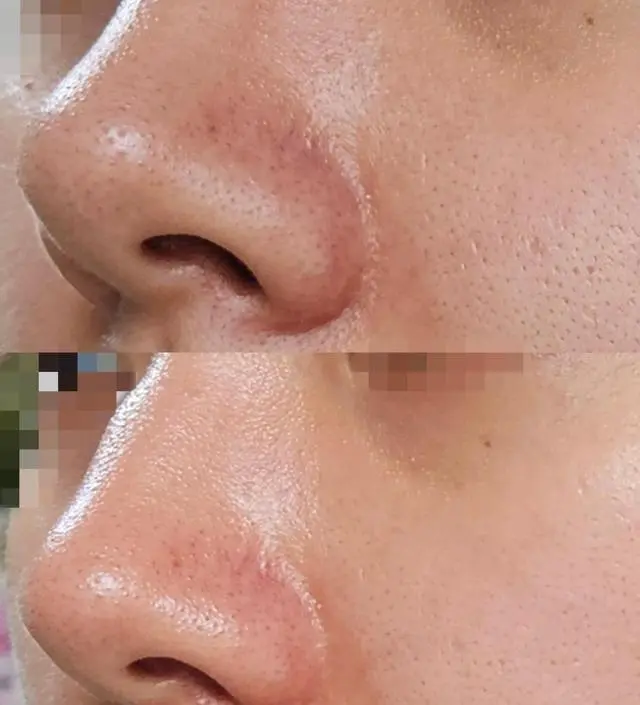오늘 처음 써봤어요 원래 리뷰 이렇게 정성스럽게 안남기는데 이거는 한번쓰고 너무 좋