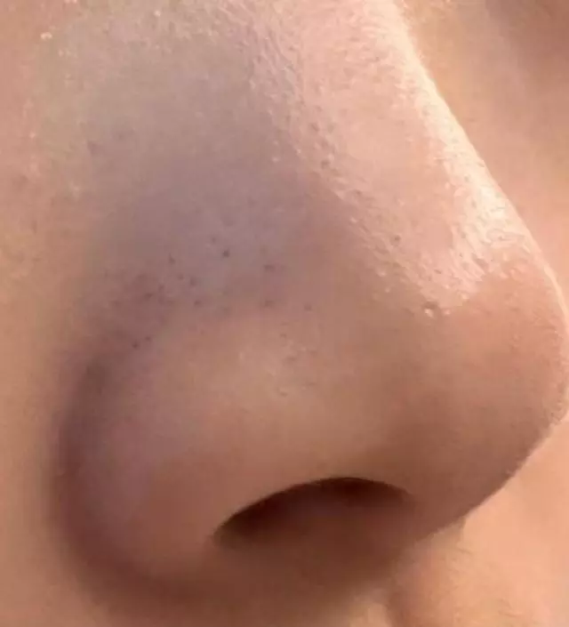 초등학생 아이 블랙헤드가 자꾸 심해지는데 오일클렌져로는 해결되지 않아서, 속는 셈 