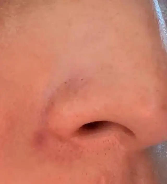 조금만 짜서 문지러도 거품이 많이 올라오네요! 블랙헤드 클렌저 이런 거는 처음 사용 