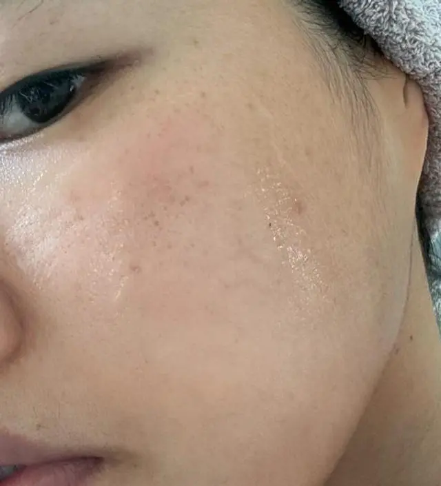 평소에 귀차니즘이 심한저는 피부케어는 별로 안한체
