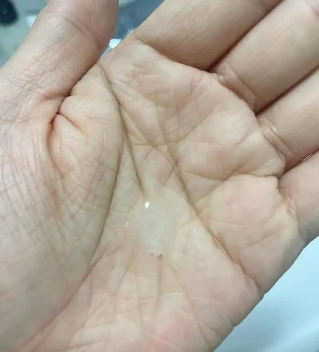코랑 턱부분 자주 보이던 블랙헤드랑 화이트헤드가 점차 옅어지고 깔끔히 제거되는게 육