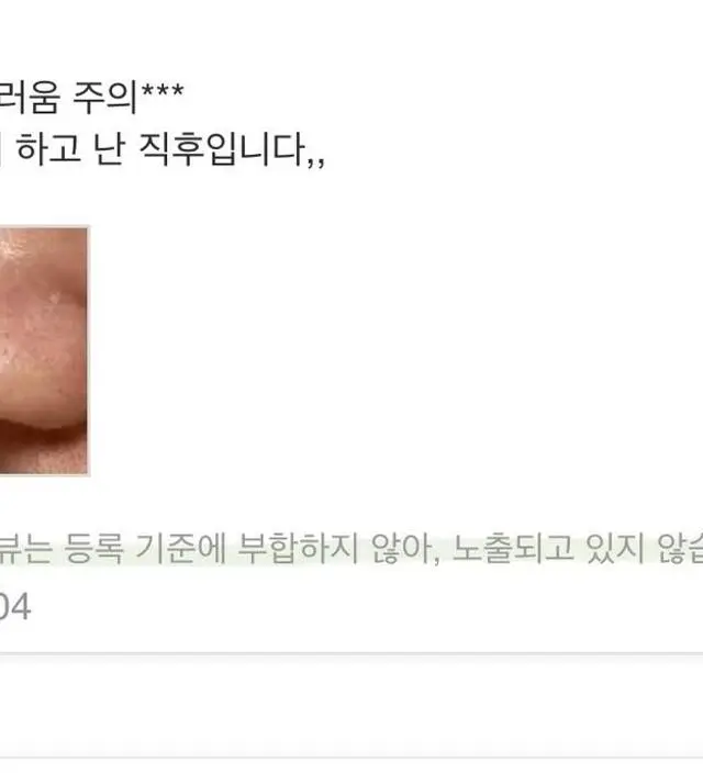 ** 앍!!! 솔직후기인데 왜 게시가 불가능하다고 뜰가요ㅠㅠ 2회차까지는 효과없다가 4회