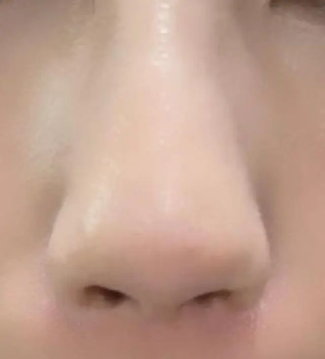 인생템이에요 블랙헤드 진짜 심해서 안 써본게 없는데 써본것중에 최고에요
