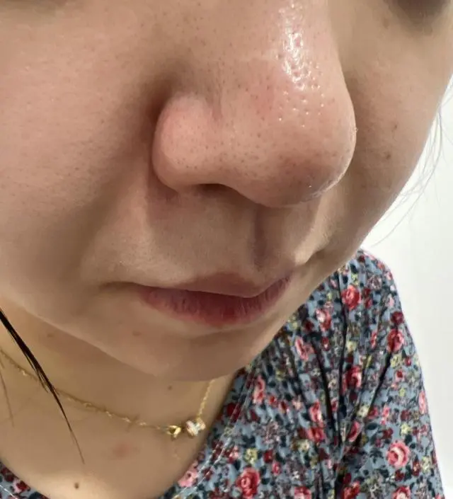 블랙헤드 너무 심해져서 우연히 보게된 인스타 광고보고 사봤어요.1회써봣는데 개운한 