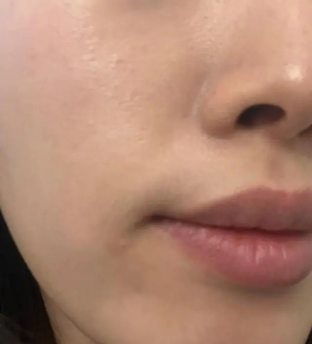 꾸준히 사용은 못하는데 모공이 좀달라진거같긴해요
