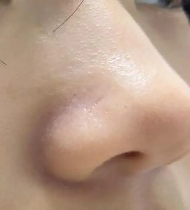 무조건 사세요 저 얼굴 겁나 민감한데 이건 걍 천사 그 잡채임 세안하고 나면 무결점 필