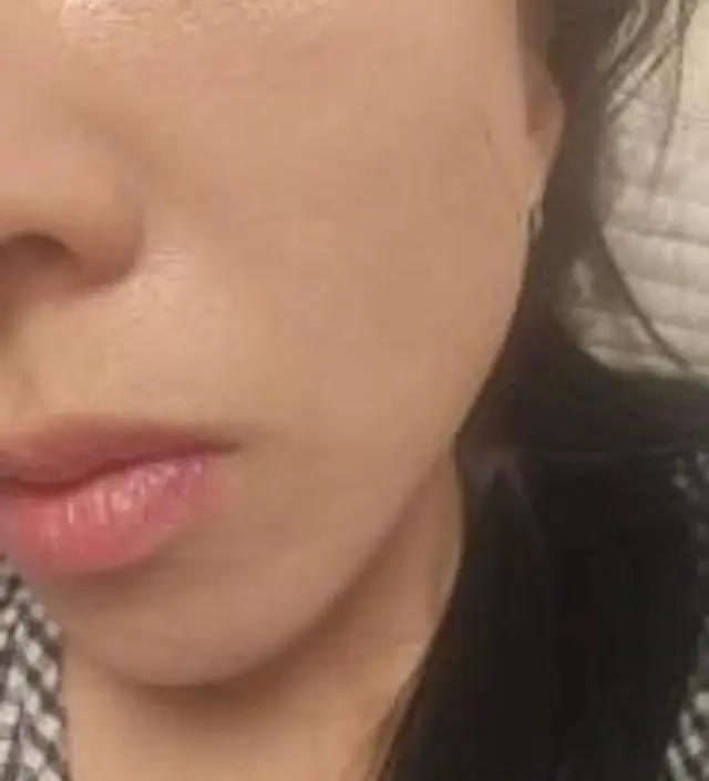 모공좁아지길바랍니다 과대광고아니길
