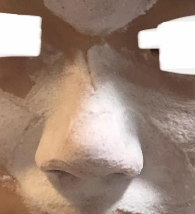 저는 중3 학생인데요, 이 니프달로 저의 지독한 악연을 끊어냈습니다. 저는 중학교 입학