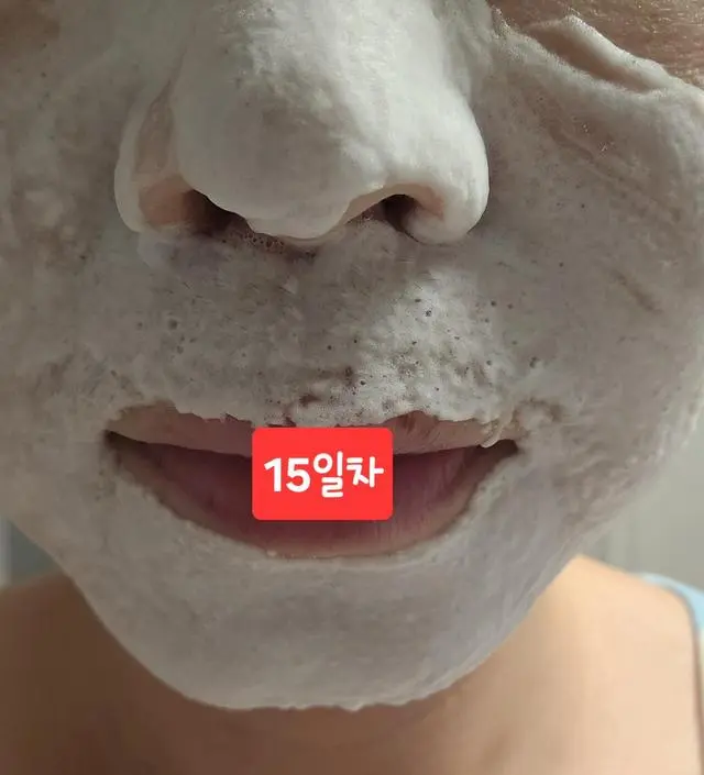 여름이 되면서 블랙헤드가 두드러지고 모공이 넓어져서 스트레스를 받던차에 광고를 접