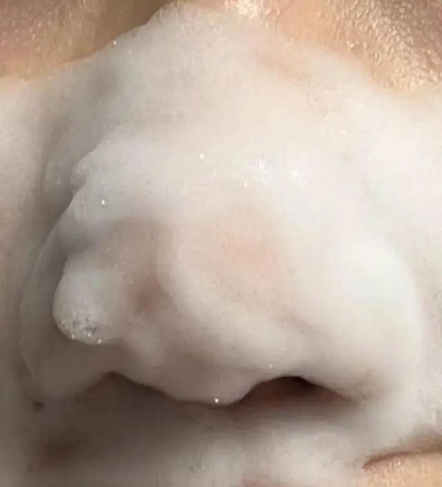 15일동안 꾸준히 사용해봤는데 효과 있어요!!
