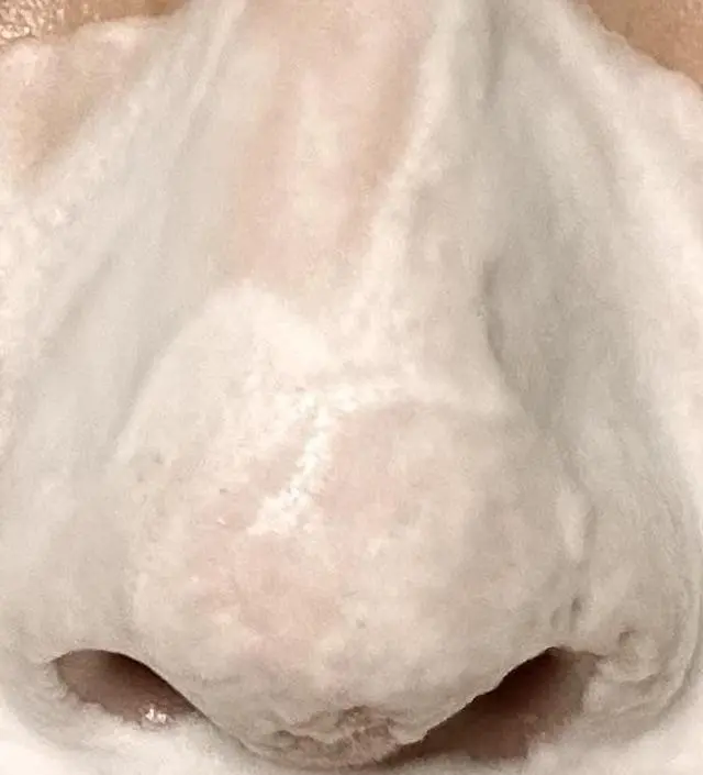 지성 피부라 블랙헤드 때문에 고민이 많았는데, 이 폼클렌징 사용 후 확실히 개선됐어요