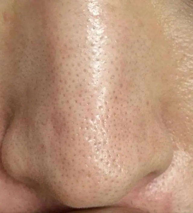 니프달과 함께하는 15일 챌린지를 마무리하며 리뷰 작성합니다.
