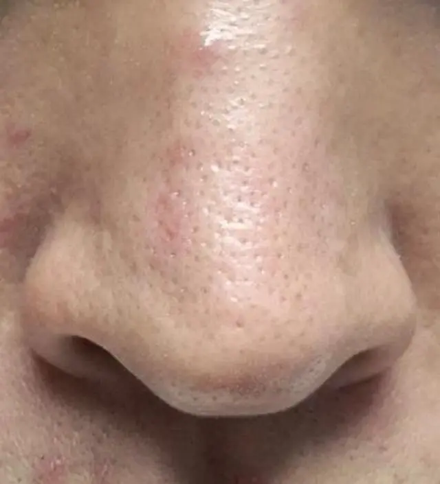 니프달과 함께하는 15일 챌린지를 마무리하며 리뷰 작성합니다.
