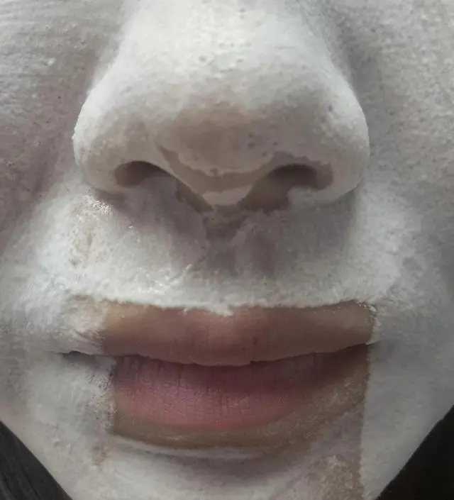 오늘이 니프달을 사용한지 딱 15일째 되는 날이네요! 솔직히 광고 봤을 땐 말도 안돼, 