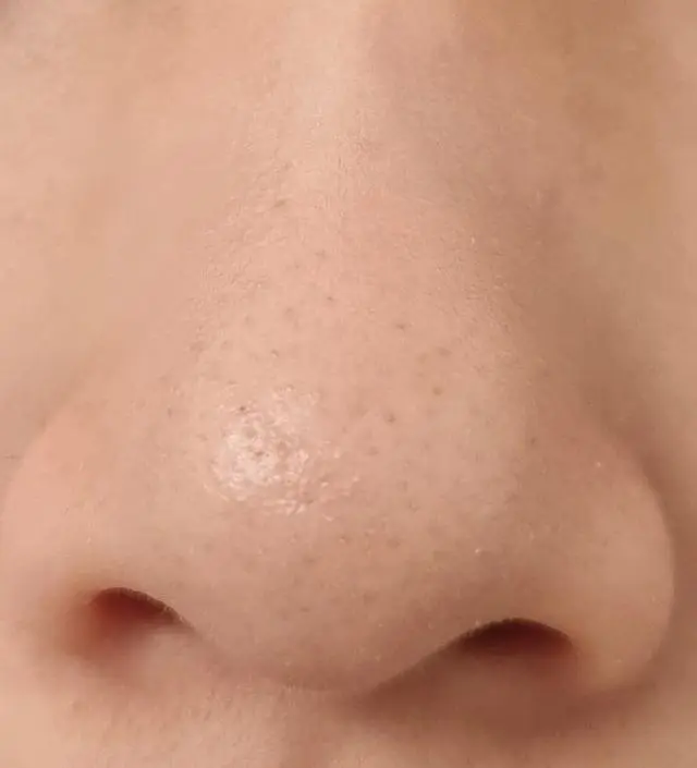 딸아이와 15일이란 시간동안 변화를 기다리며 꾸준한 니프달습관을 이어가다 첫사진과 