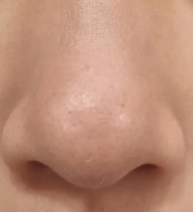 딸아이와 15일이란 시간동안 변화를 기다리며 꾸준한 니프달습관을 이어가다 첫사진과 