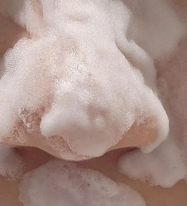 니프달 구매 후 15일간 사용했습니다.아침,저녁으로 두번씩 사용했어요. 여름철 코 피지