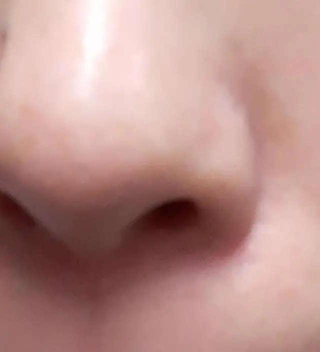 나이들면서 모공이 넓어지는게 너무 보기싫어서
