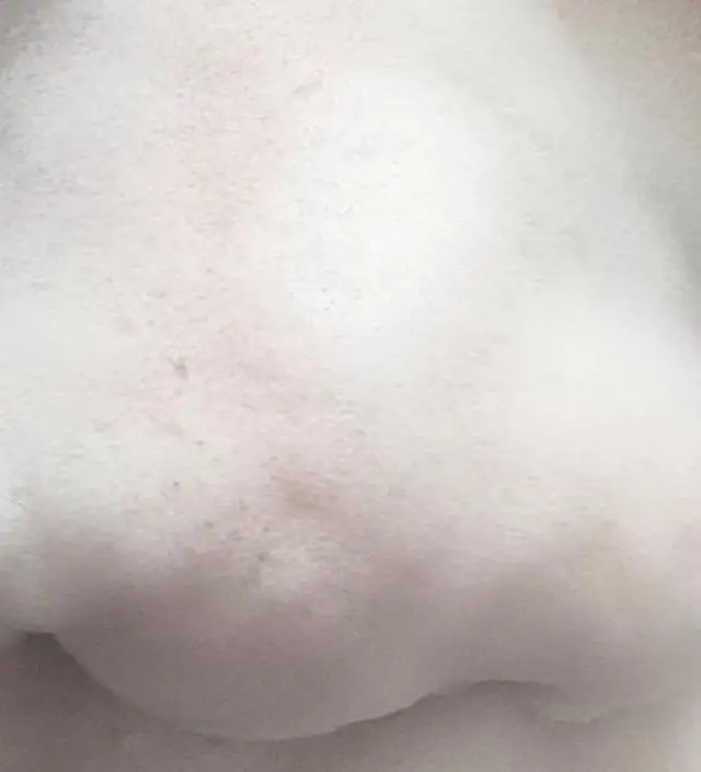클렌징 앰플을 꾸준히 사용했는데 처음과 비교했을때 블랙헤드가 눈에 띄게 줄어들어 효