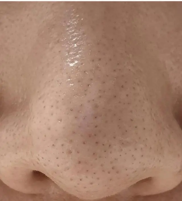 맨처음 클렌저를 알아볼때 반신반의하면서 고민고민하다 구입하게되었어요 모공도 크고