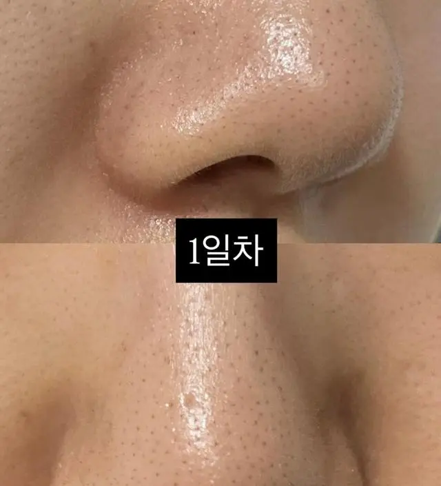 딸기코를 벗어나고자 찐리뷰인 제품을 찾고있었어요. 

