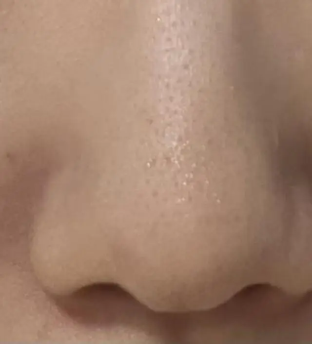 딸기코를 벗어나고자 찐리뷰인 제품을 찾고있었어요. 
