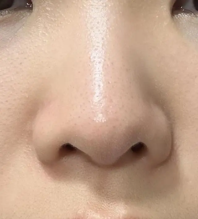 15일 동안 꾸준히 사용하고 작성하는 후기입니다~~ 처음에는 반신반의하며 구매했었는데