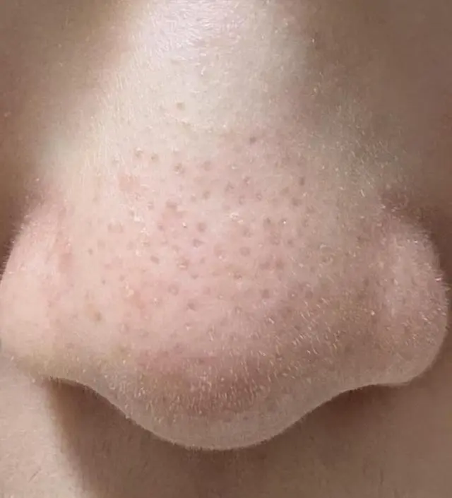 만족
