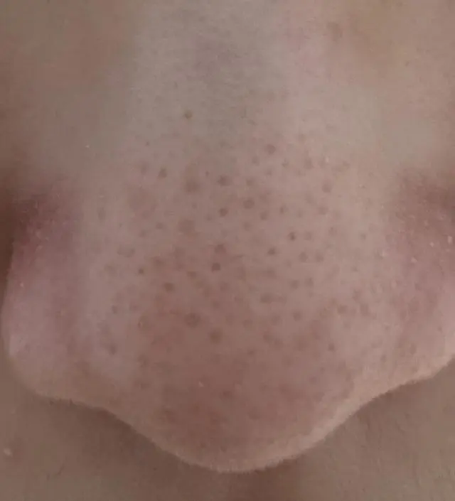 만족
